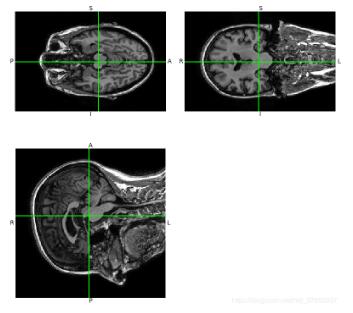 python 读取.nii格式图像实例
