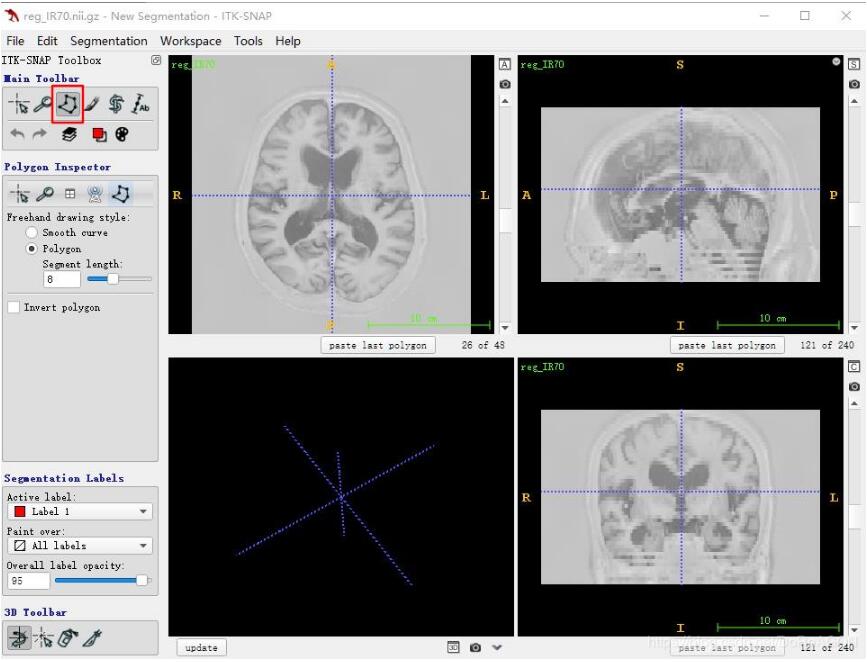 使用ITK-SNAP进行抠图操作并保存mask的实例